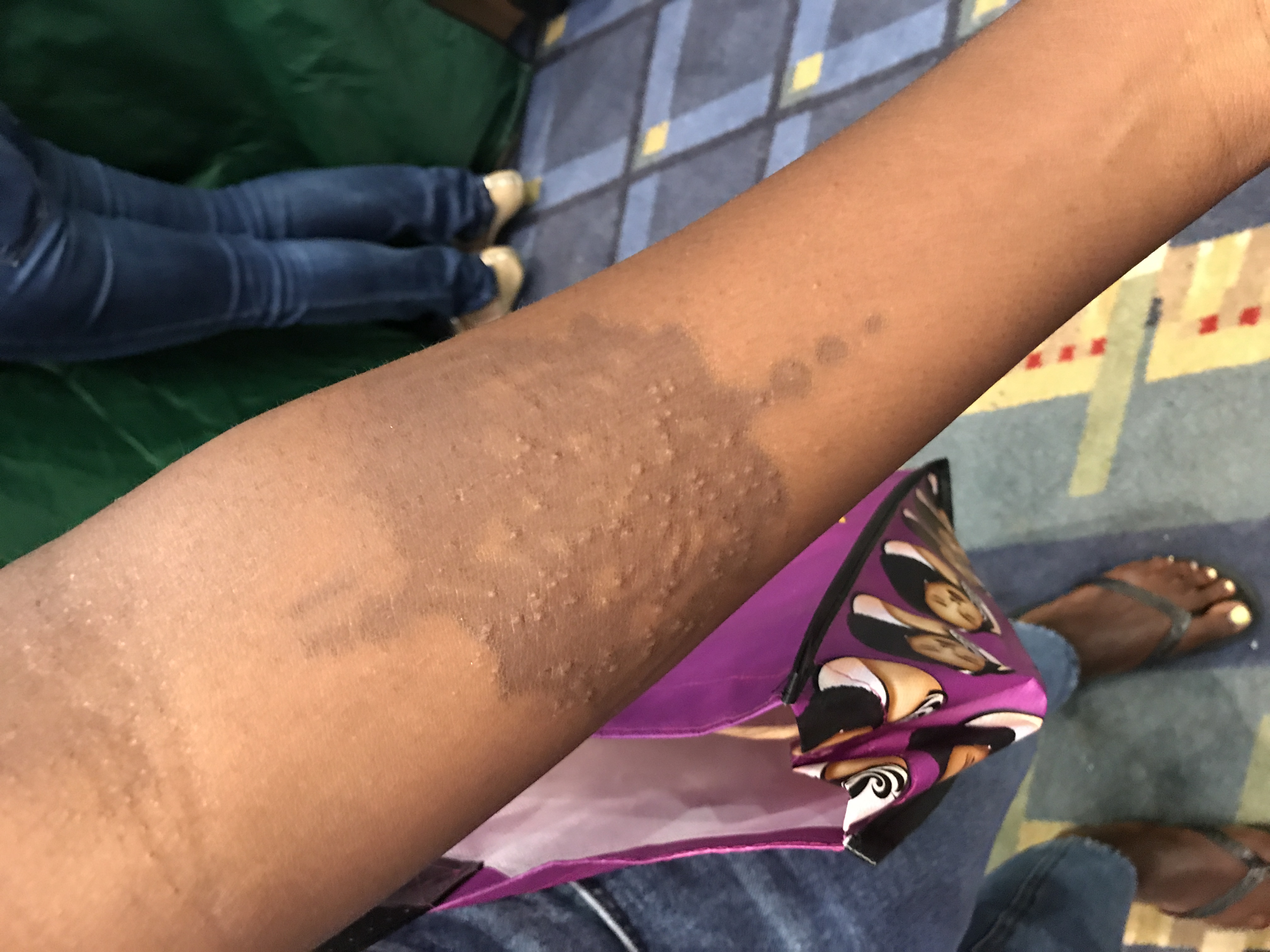 Warning of the Harms of Black Henna | Henna Blog Spot